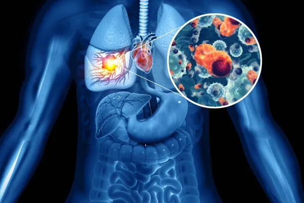 Elevating Lives Through Pulmonary Care at Galaxy C...