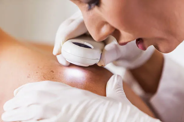 "Dermatology Clinic in Nashik: Your Skin's Sanctua...