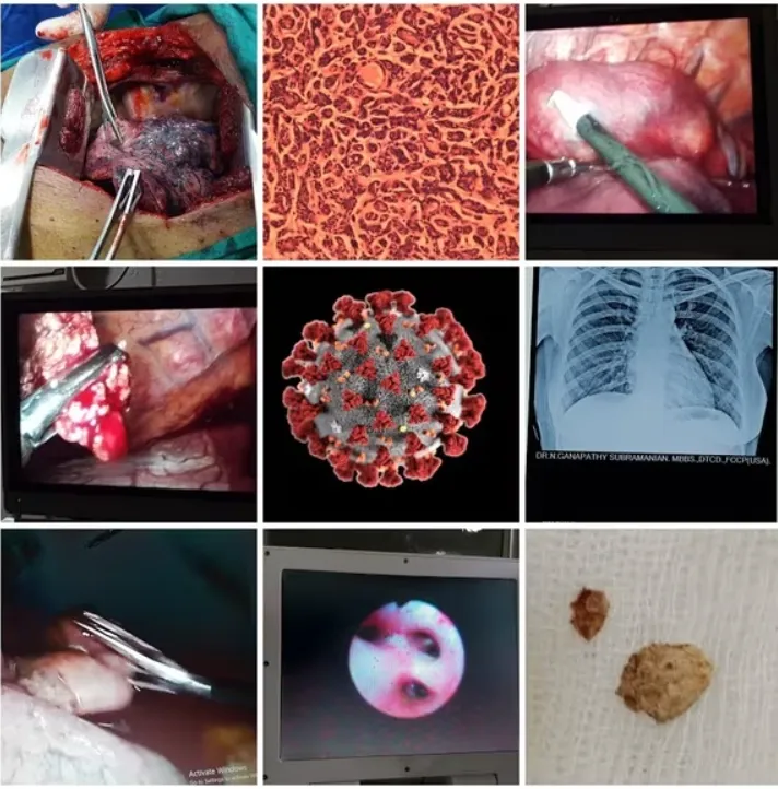 "Comprehensive Chest Care: Galaxy Chest Hospital, ...
