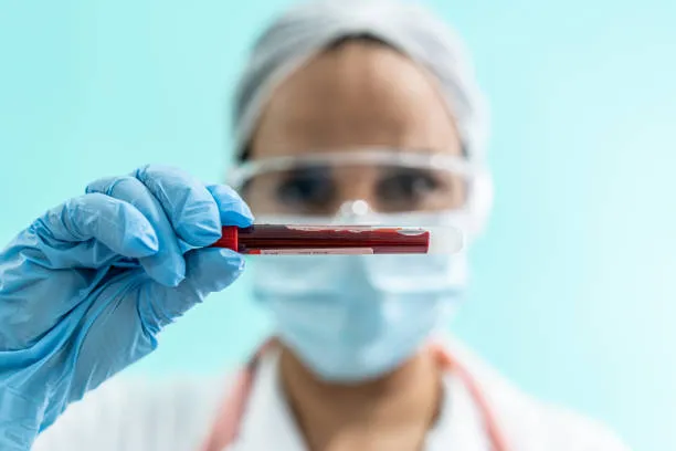 "Unlocking Hope: Best Hematologist in Nagpur" Dr. ...