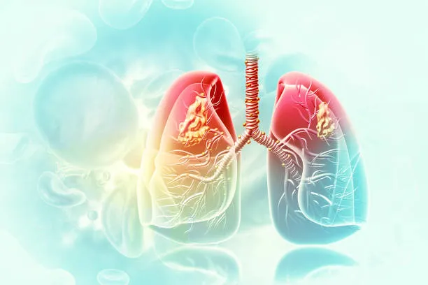 Galaxy Chest Hospital: Your Destination for Lung H...
