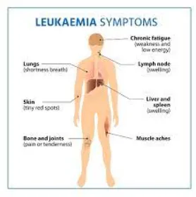 "Championing Leukemia Care: Dr. Atish Bakane" Best...