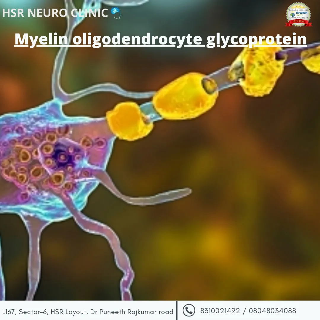 Testing and diagnosis of MOG Antibody Disease
Diag...