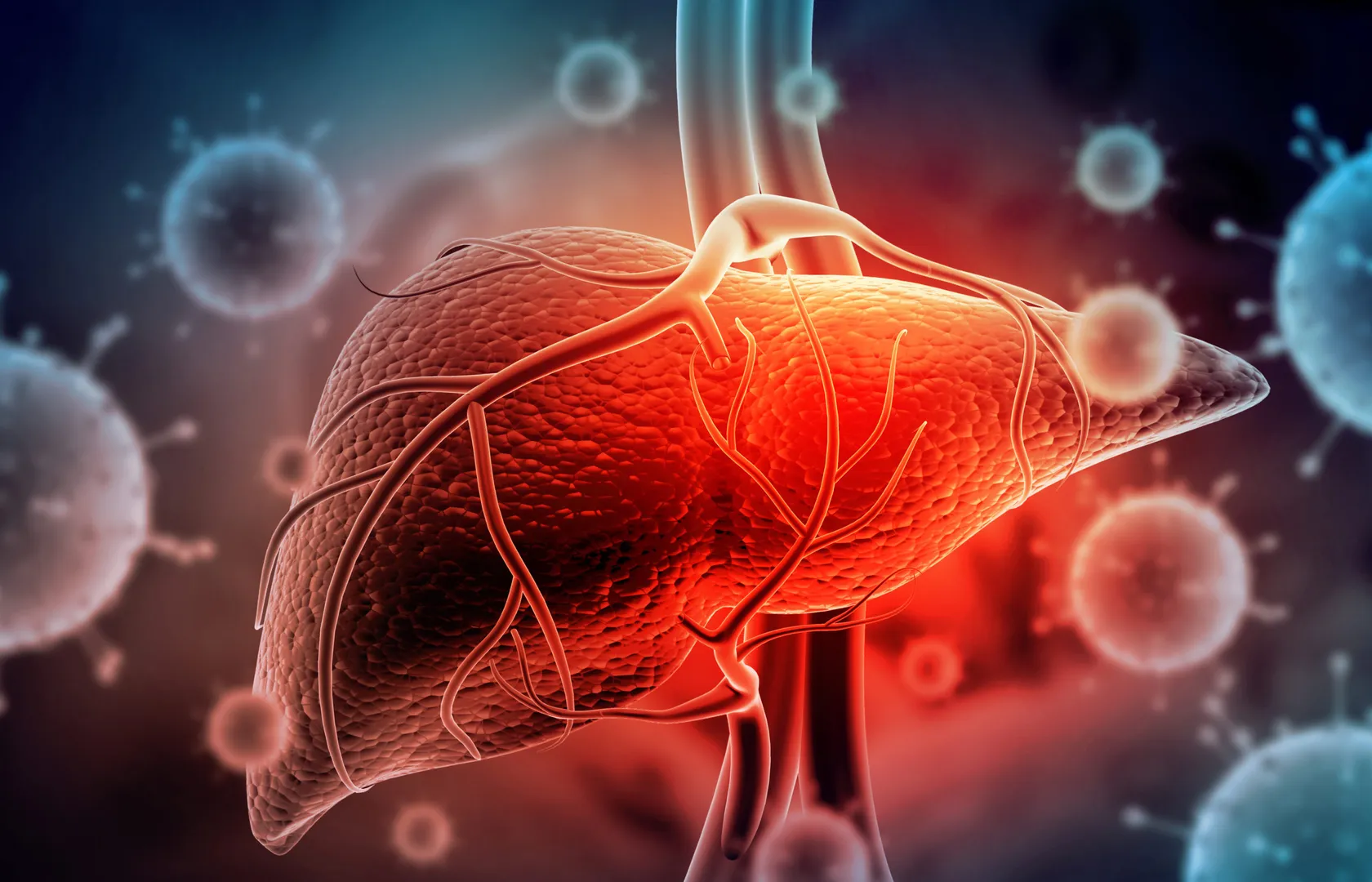 Hepatitis Hepatitis is a medical condition charact...