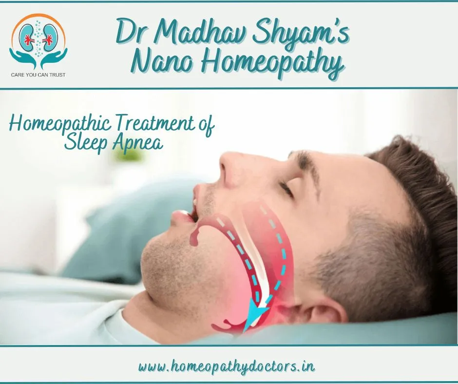 Sleep apnea is a potentially serious sleep disorde...