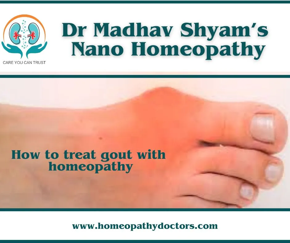 Gout is a painful form of arthritis caused by uric...