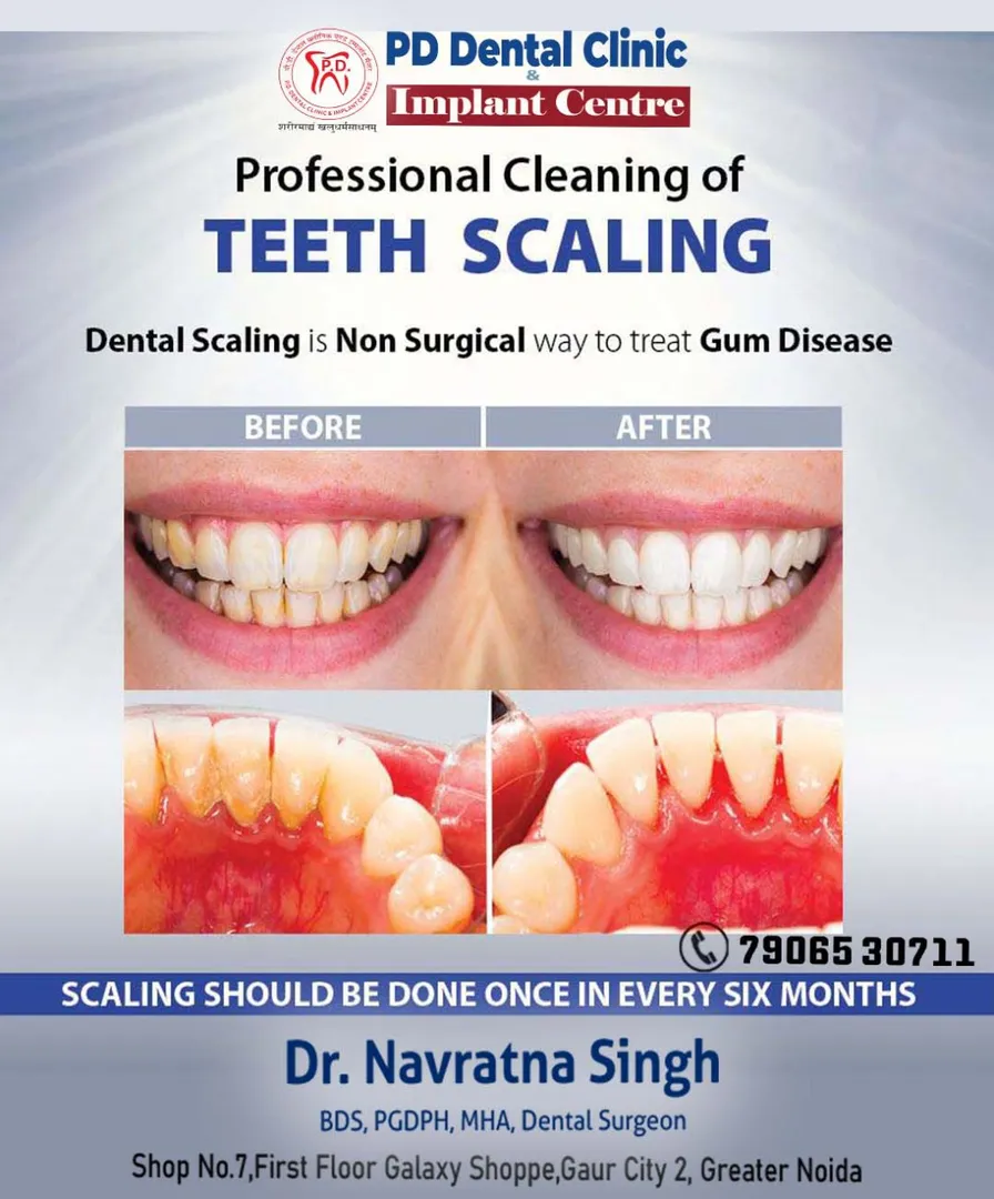 #scaling
#oralprophylaxis
#teethcleaning
#scaling&...