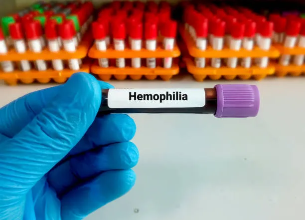 "Hemophilia Unveiled: Expert Insights from Dr. Ati...