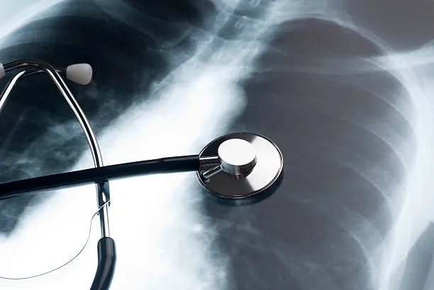 Galaxy Chest Hospital: Pediatric Pulmonology Excel...