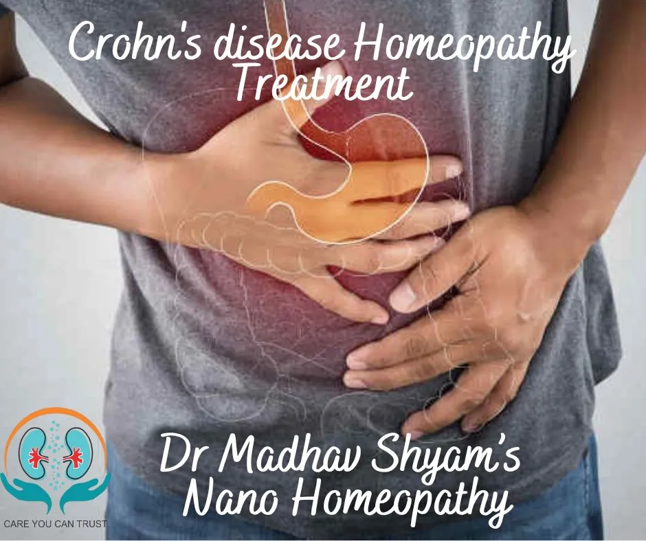 Crohn's disease is a type of inflammatory bowel di...