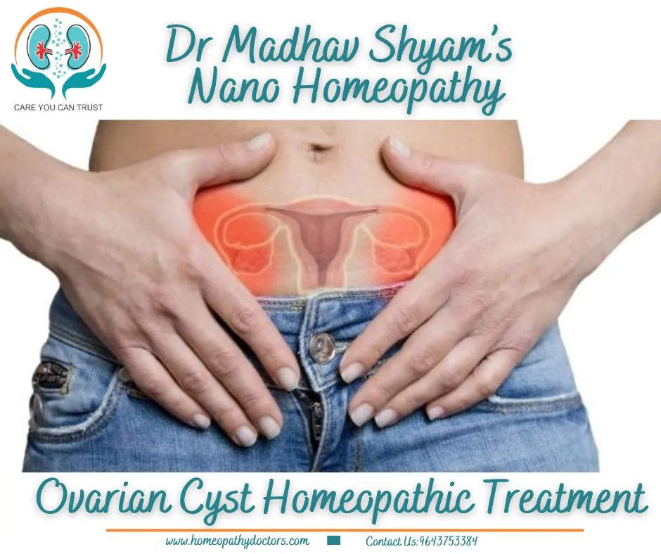 An ovarian cyst is a sac filled with fluid that fo...