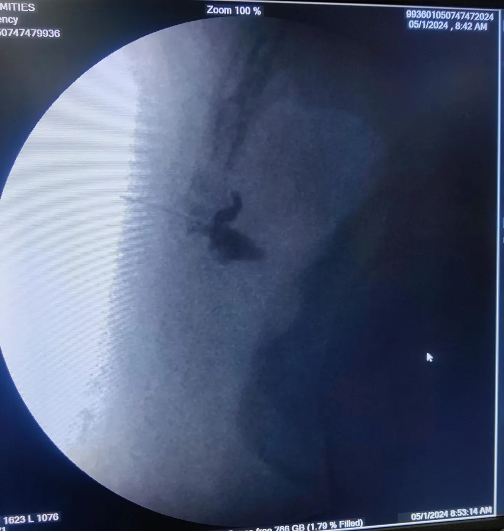 are you looking for coccydynia doctor in Pune?
Are...
