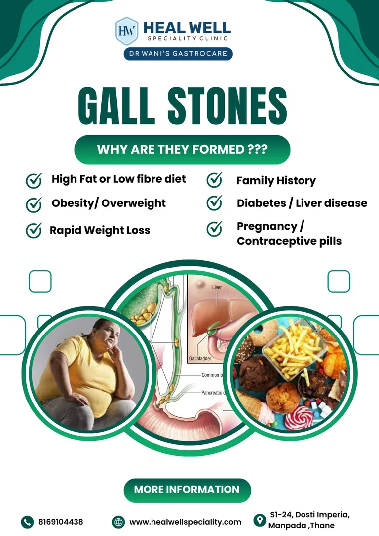 Part 2 of the Gallstones Series:
Let's explore the...
