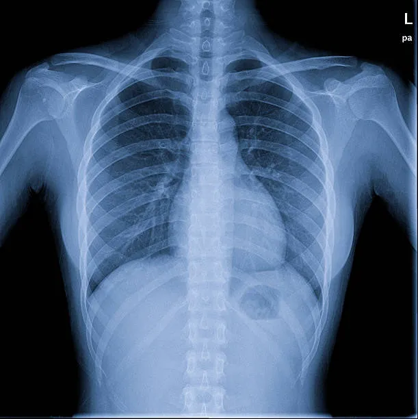 Galaxy Chest Hospital Trichy: Elevating Chest Care...