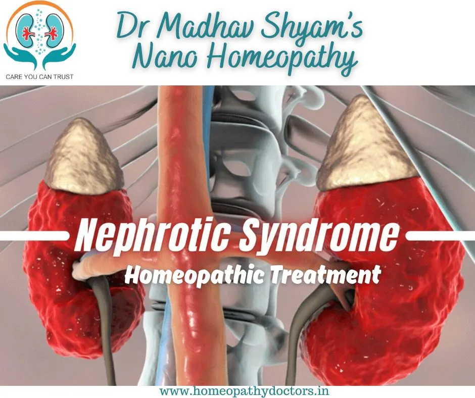 Nephrotic syndrome may occur when the filtering un...