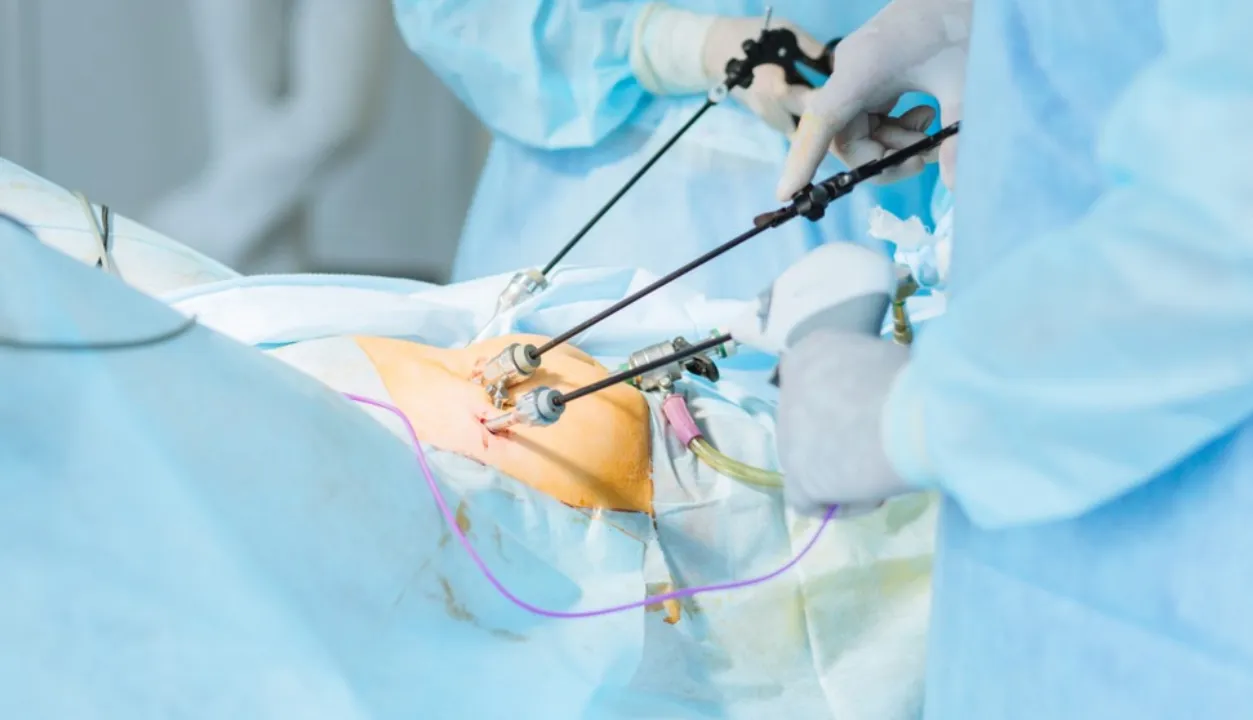 #Advanced Laparoscopic Hysterectomy in Thane
#Lapa...