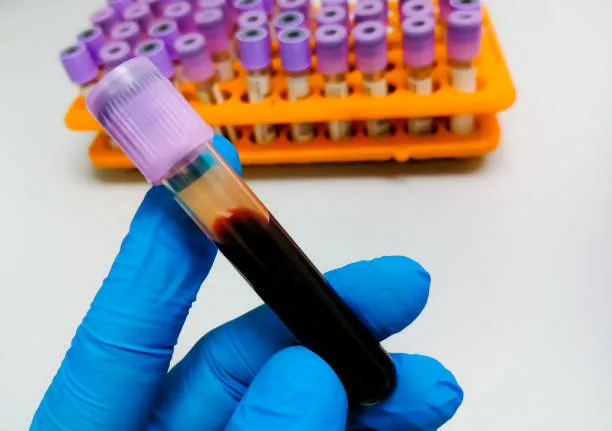Unraveling Hematological Mysteries with Dr. Atish ...