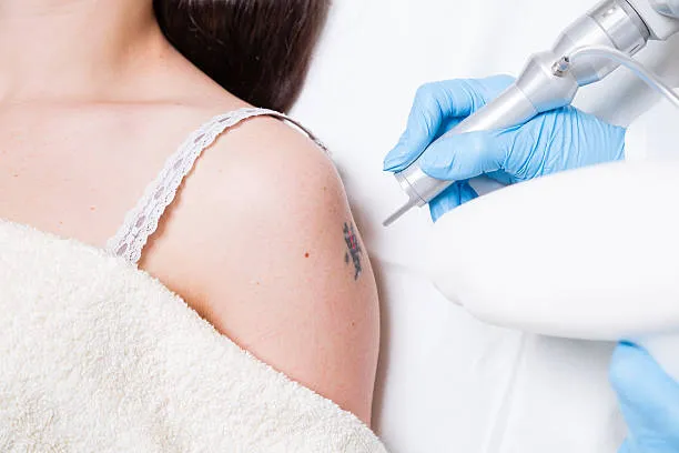 Radiant Skin Awaits: TRu Aesthetics' Laser Cosmeti...
