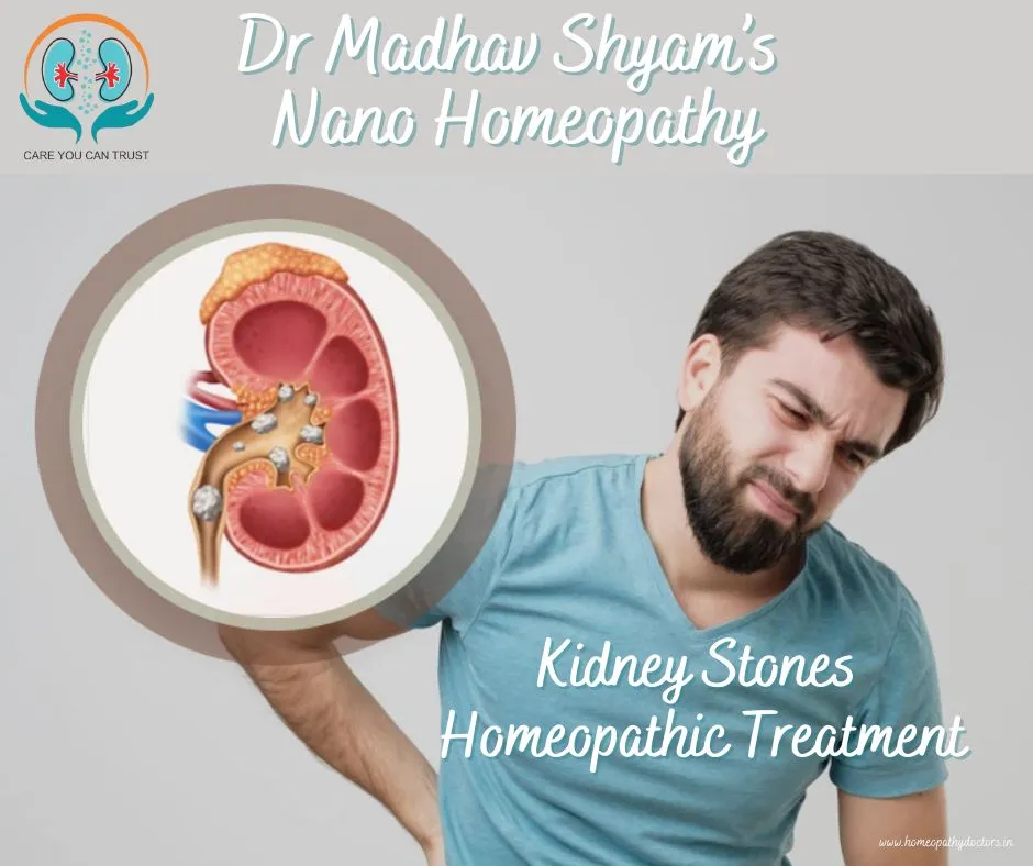 Homeopathic Medicines for Kidney StonesThe well-kn...
