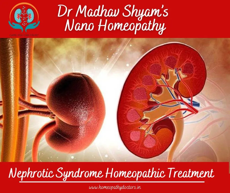 Nephrotic syndrome is an indicator that the kidney...