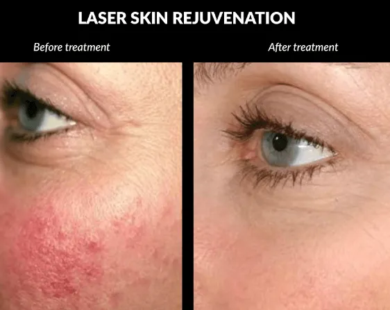 Skin and Laser Clinic at Dr. Richa's Unique Clinic...