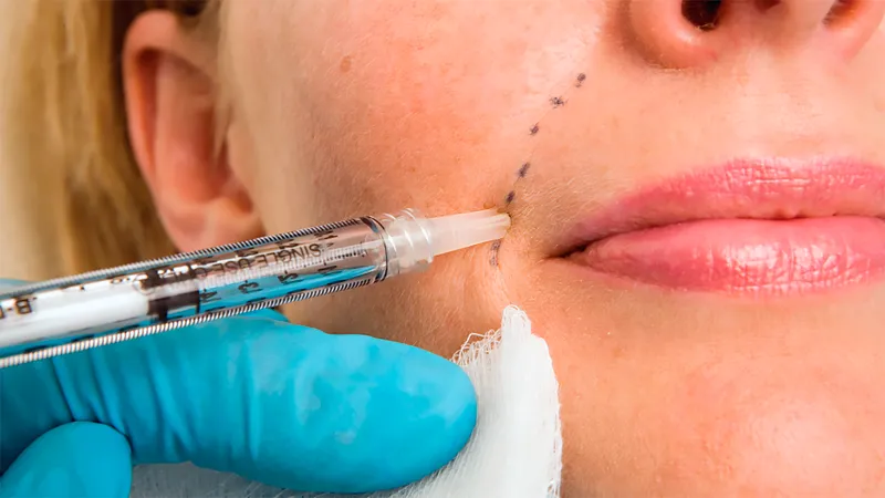 Dermal Fillers in West Delhi
Achieve plump, well-...