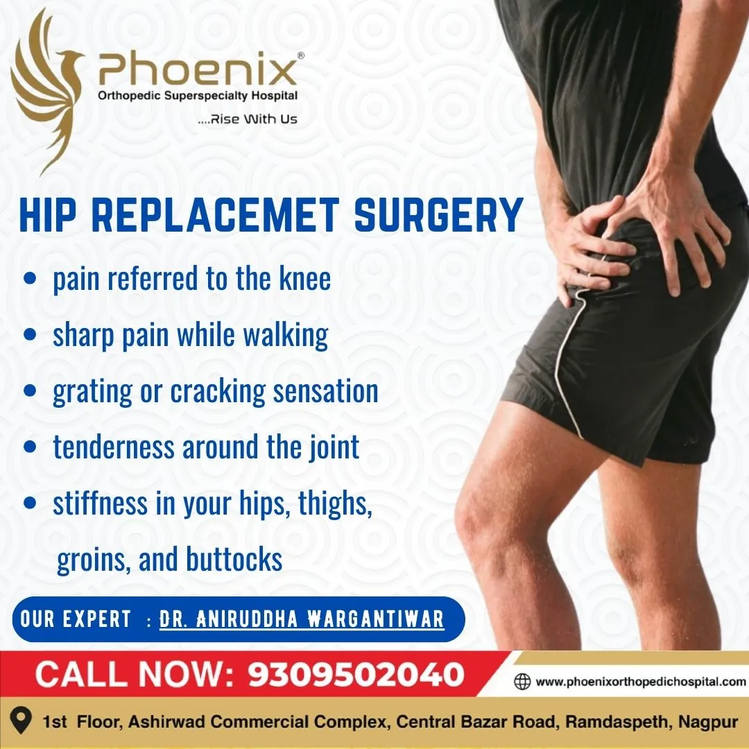 Hip replacement surgery is a medical procedure whe...