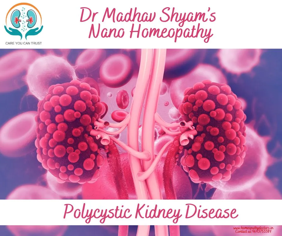 What is Polycystic Kidney Disease?
Polycystic kid...