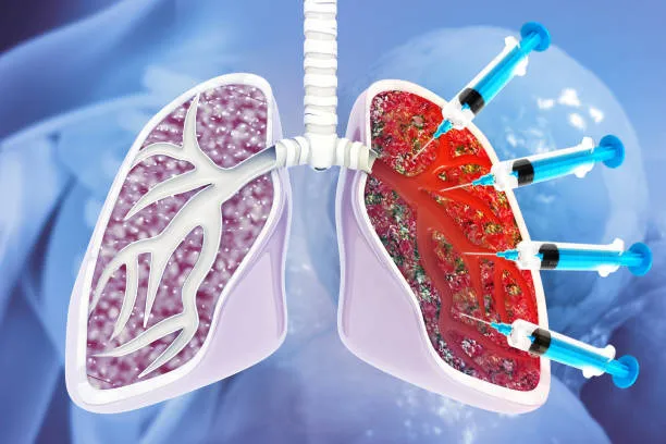 Finding the Best Pulmonologist Near You for Chest ...