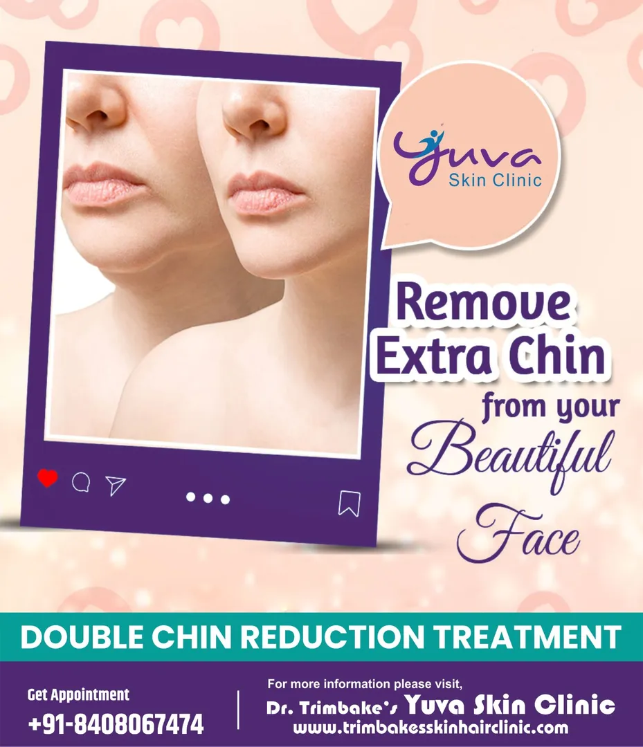 Double Chin Reduction Treatment
Although chubby ch...