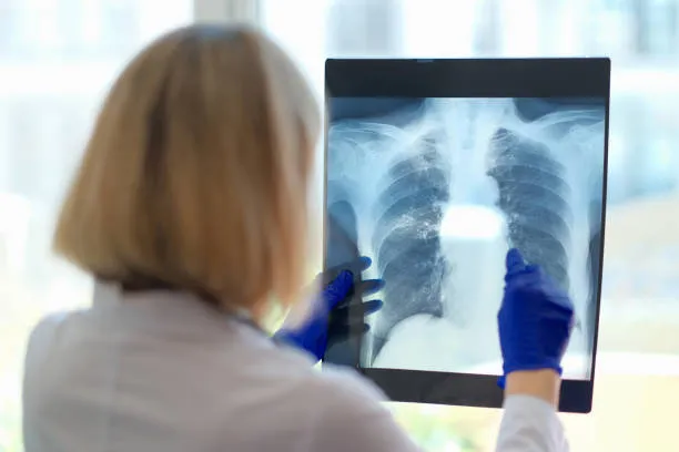 Prevention, Diagnosis, and Treatment Options Preve...