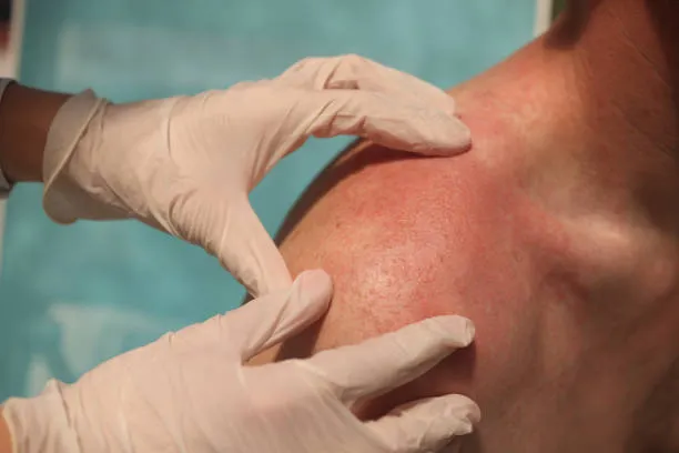 Transform Your Look at TRu Aesthetics: The Best Sk...