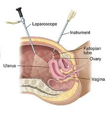 Ivf clinic in Wagale estate Thane
best ivf doctor...