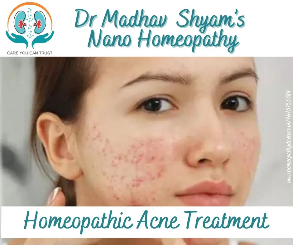 Acne is a common skin condition, usually on the fa...