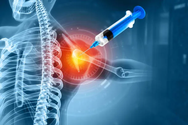 Dr. Rakesh Gosavi: Your Partner in Long Bone Fract...