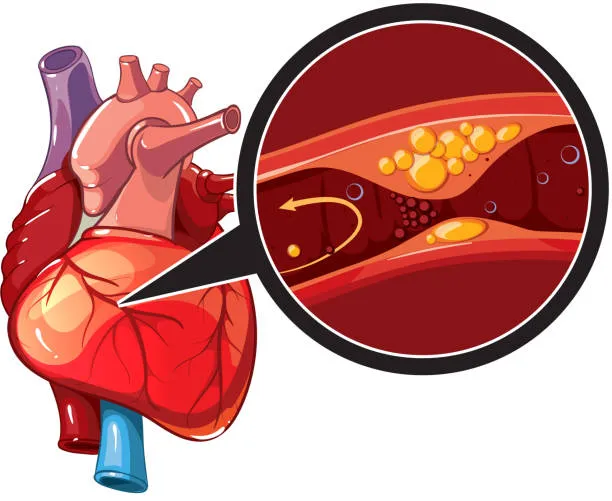SR Heart Clinic: Your Trusted Partner in Fighting ...