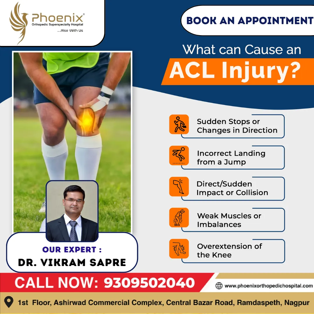 What can cause an ACL Injury ? #bestorthopedichosp...