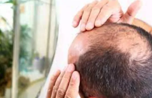 Say Goodbye to Hair Woes: Hair and Baldness Clinic...