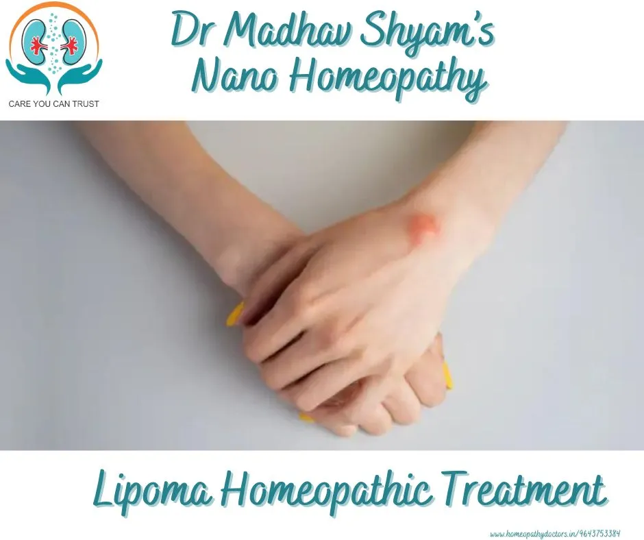 Lipoma Homeopathic Treatment
Have you felt that so...