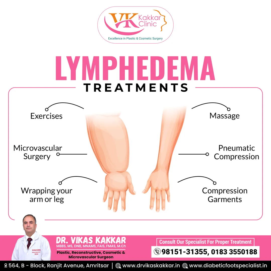 If you're at an Early risk of lymphedema, try doin...