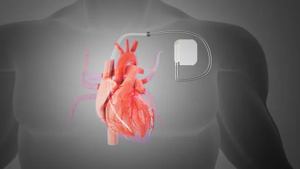 Excellence in Cardiac Surgery: Dr K G Deshpande Me...