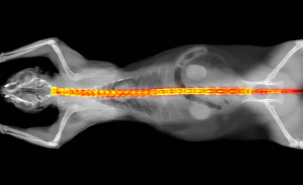 Mastering Musculoskeletal Oncology: Insights by Dr...