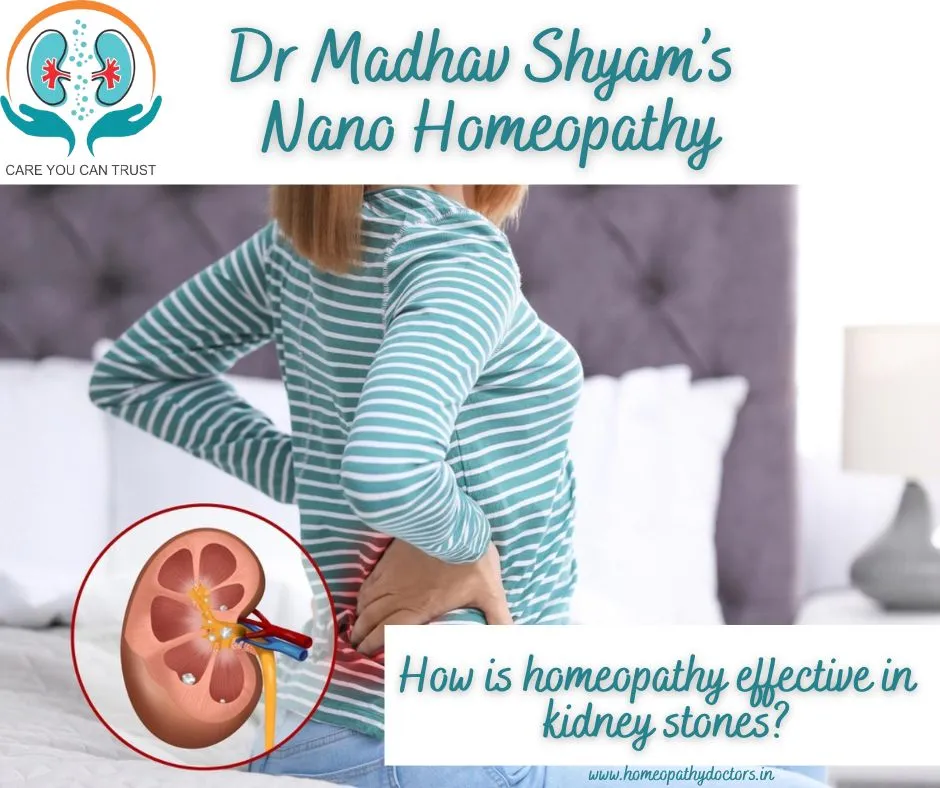 Kidney stones, medically known as renal calculi, a...