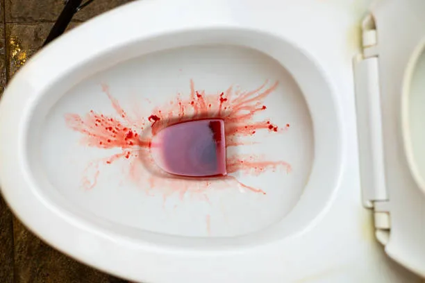Managing Blood in Urine: Expert Care in Thane West...