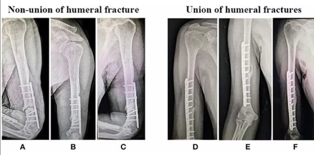 Dr. Rakesh Gosavi: Leading Fracture Specialist in ...