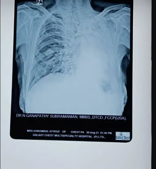 Elevating Pulmonary Care: Galaxy Chest Hospital, T...