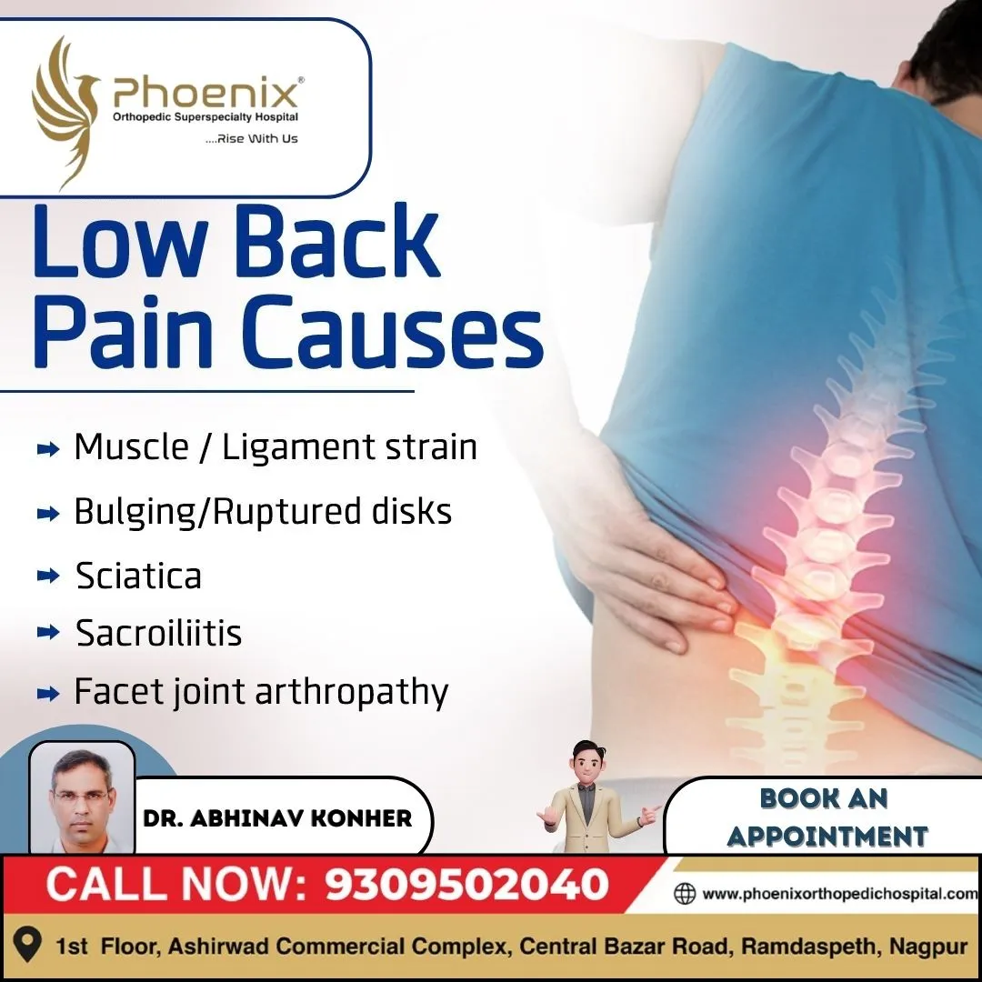 LOW BACK PAIN CAUSES Consultants At : 1st Floor, A...