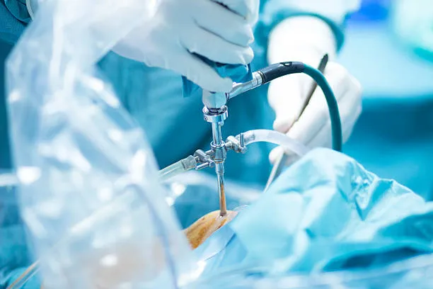 Unveiling the Precision of Arthroscopy: Enhancing ...