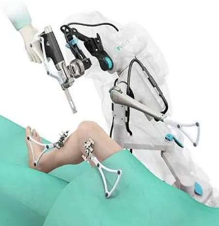 Empowering Lives Through Robotic Joint Replacement...
