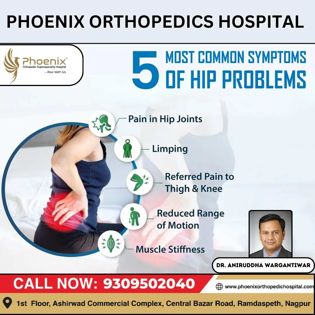 5 Most Common Symptoms Of Hip Problems Consultants...